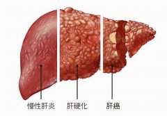 廣州送菜公司了解富川富陽鎮(zhèn)千畝蔬菜種植基地助農(nóng)增收